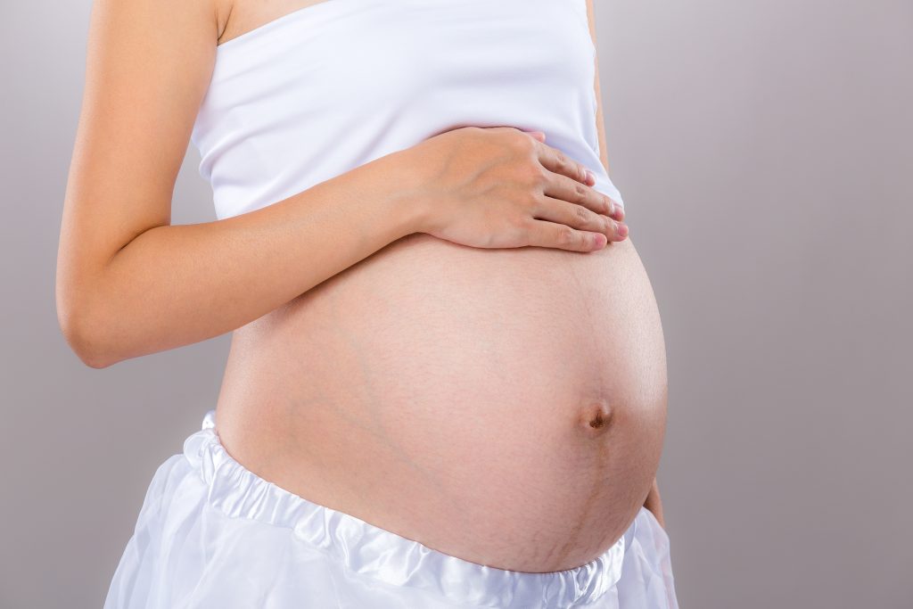 Leistenbruch in der Schwangerschaft